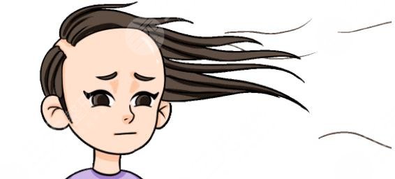 發(fā)際線(xiàn)種植