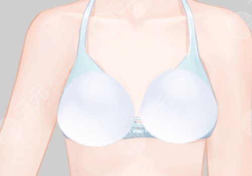 隆胸假體的價(jià)格