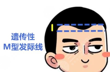 發(fā)際線種植