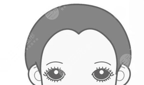 深圳雍禾植發(fā)