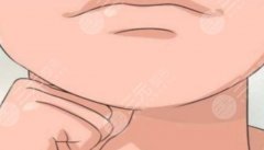 頦成型下巴銜接不自然？第一次頦成型不夠還能做第二次嗎?
