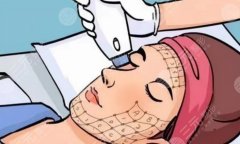 熱瑪吉的功效與功能分析|術(shù)后可以維持多長時(shí)間呢？