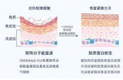 熱瑪吉和超聲炮的區(qū)別是什么？做了多久恢復？