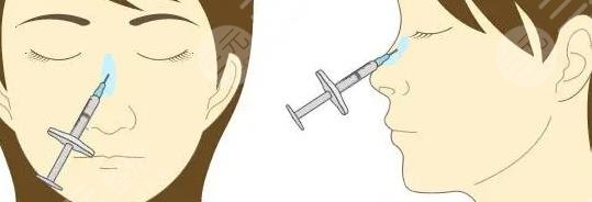 注射隆鼻