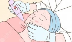 黃金微針做一次有效果嗎？原理get！可以哪些問題呢？