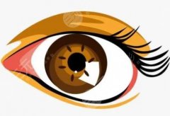 眼綜合和割雙眼皮有什么區(qū)別？眼綜合包括哪些項(xiàng)目？科普