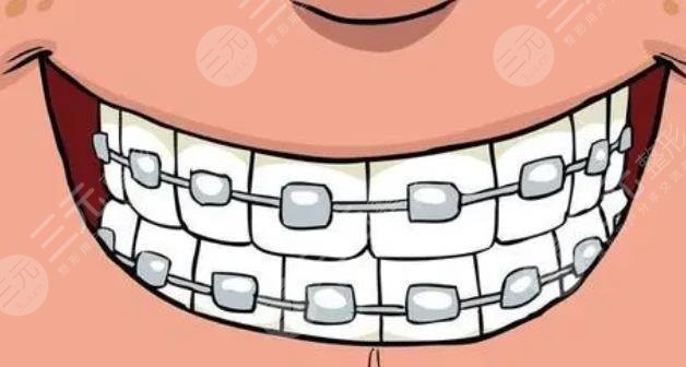 牙齒矯正