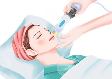 光子嫩膚