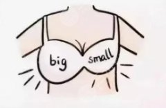 假體隆胸多久能恢復(fù)正常？做隆胸手術(shù)前要做哪些準(zhǔn)備？