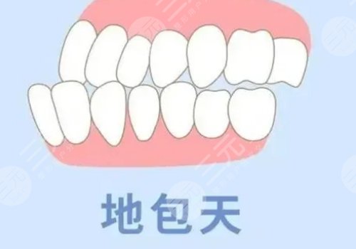 章建林正頜手術(shù)怎么樣