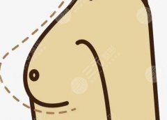 內(nèi)窺鏡隆胸的弊端是什么？術(shù)后可以維持多長時(shí)間呢？