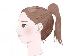 頦成型和正頜哪個風(fēng)險大？做面部整形后注意事項有哪些？