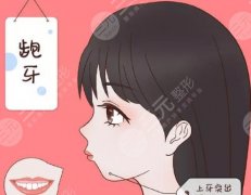 凸嘴矯正后下巴會(huì)變長(zhǎng)嗎？矯正后有哪些風(fēng)險(xiǎn)？費(fèi)用參考