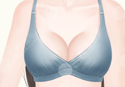 上海九醫(yī)院徐華和王濤乳房再造哪個(gè)好