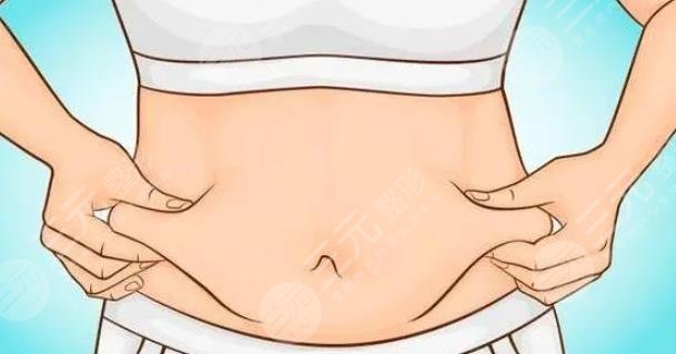 腰腹吸脂