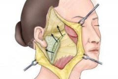 北京八大處拉皮手術(shù)多少錢？收費(fèi)標(biāo)準(zhǔn)|醫(yī)院口碑評(píng)價(jià)來襲！