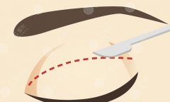 貴陽省醫(yī)做雙眼皮大概多少錢？醫(yī)院資料|詳細(xì)地址|價(jià)目表一覽！