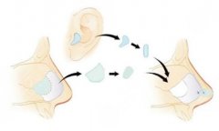 青海紅十字醫(yī)院隆鼻價(jià)格貴不貴？2025項(xiàng)目收費(fèi)表一覽！