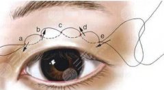 青海省人民醫(yī)院割雙眼皮費(fèi)用貴不貴？新版價(jià)格表2025分享！