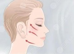 北京八大處拉皮價(jià)目表更新！醫(yī)院詳細(xì)地址、顧客真實(shí)點(diǎn)評(píng)！