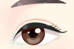 貴州省人民醫(yī)院整形科雙眼皮多少錢？20225項目價格表參考！