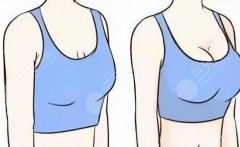 青海大學(xué)附屬醫(yī)院隆胸多少錢？2025醫(yī)院價目表出爐！收藏再看