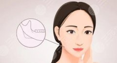 面部輪廓調(diào)整醫(yī)美多少錢？醫(yī)美整形方式有哪些可以選擇？