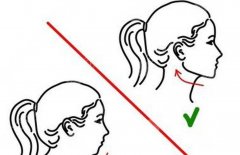 下巴后縮正頜手術(shù)可以嗎？會不會有什么后遺癥？