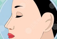 超肋鼻綜合價格貴不貴？哪個效果比較好？來看詳細介紹