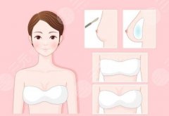 江蘇省中醫(yī)院隆胸價(jià)格表一覽！院內(nèi)熱門項(xiàng)目技術(shù)盤點(diǎn)！