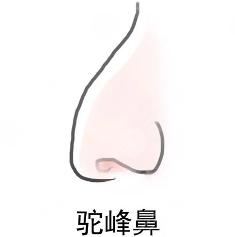 駝峰鼻動(dòng)漫