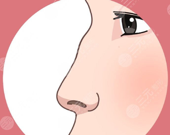 駝峰鼻動(dòng)漫