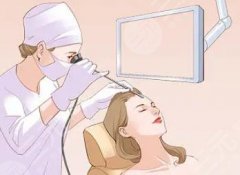 內(nèi)窺鏡除皺術維持多久？除皺術有哪些優(yōu)勢？