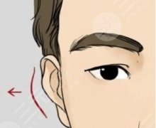 外耳廓重塑的手術科普！手術修復方法有哪些？