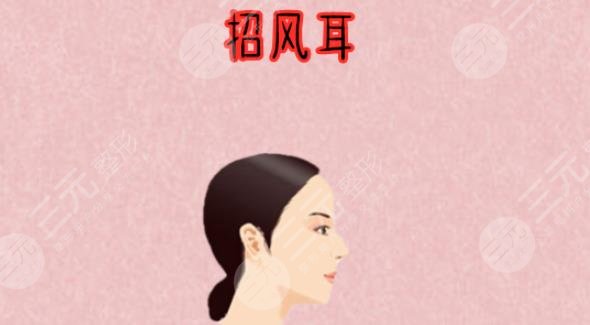 招風(fēng)耳
