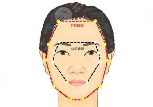 北京協(xié)和醫(yī)院夏澤楠醫(yī)生臉部整形怎么樣