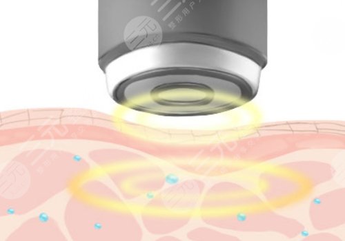 南醫(yī)大深圳醫(yī)院除皺多少錢