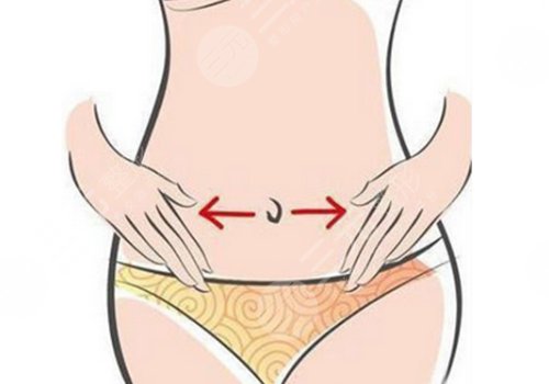 哈爾濱羽禪醫(yī)美楊宇梓做腰腹環(huán)吸怎么樣