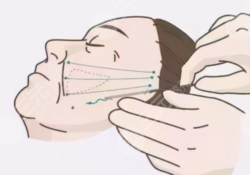 天津伊美爾做拉皮手術(shù)哪個(gè)醫(yī)生好？袁志瑋醫(yī)生值得信賴(lài)！