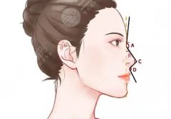 北京沃爾趙丹和馮雁平誰做鼻子好？兩位醫(yī)生實力技術(shù)剖析！