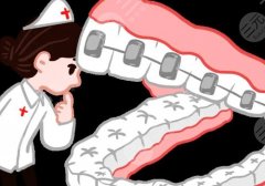 杭州正畸李詩佩怎么樣？20多年經(jīng)驗！附個人資料、牙齒矯正案例