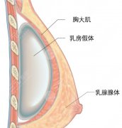 馮傳波醫(yī)生隆胸技術(shù)分析|胸部整形科普問答！