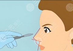 新華醫(yī)院隆鼻修復(fù)怎么樣？對(duì)隆鼻修復(fù)特別精通！附25年價(jià)格表