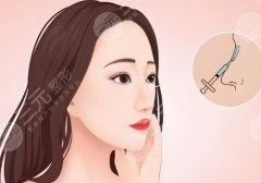 中國(guó)醫(yī)學(xué)科學(xué)院整形外科醫(yī)院鼻整形哪個(gè)大夫更擅長(zhǎng)？宋濤、謝洋春、趙延勇等醫(yī)生實(shí)力pk