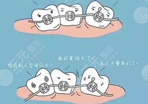 天津市口腔醫(yī)院牙齒矯正費(fèi)用