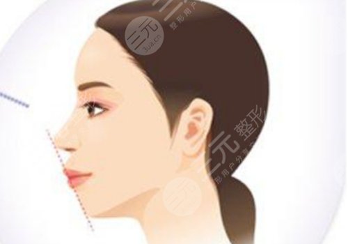 樸興植是正頜界的佼佼者嗎