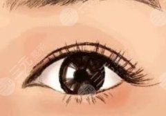 杜園園雙眼皮修復技術怎么樣？20多年經(jīng)驗、審美在線、發(fā)揮穩(wěn)定！