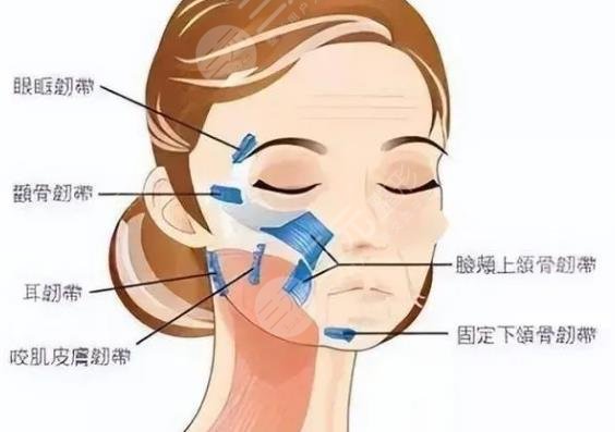 面部筋膜懸吊術(shù)