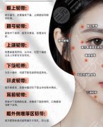 線雕面部提升能維持多久？使用的線材哪種比較好？