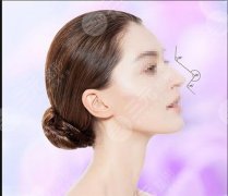 廣州櫻美醫(yī)療美容口碑怎么樣？網(wǎng)紅醫(yī)美口碑實力測評！